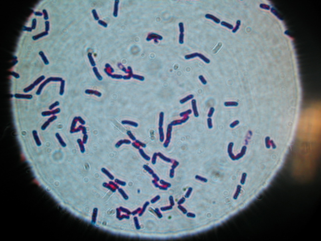 Lebensmittelvergiftung durch Bacillus cereusBakterien MedDe